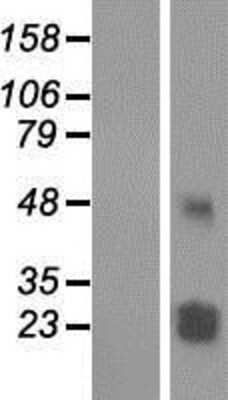 Western Blot: TMEM61 Overexpression Lysate [NBP2-04854]