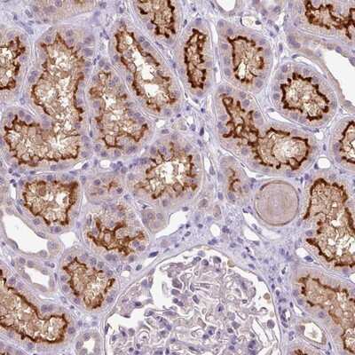 Immunohistochemistry-Paraffin: TMEM62 Antibody [NBP2-14537]