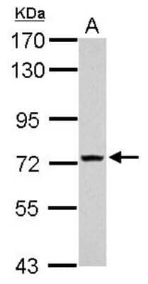 Western Blot: TMEM62 Antibody [NBP2-20665]