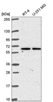 Western Blot: TMEM62 Antibody [NBP2-56585]