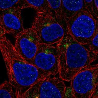 Immunocytochemistry/ Immunofluorescence: TMEM63A Antibody [NBP2-56514]