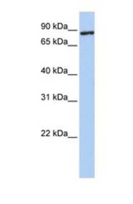 Western Blot: TMEM63A Antibody [NBP1-69249]