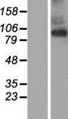 Western Blot: TMEM63A Overexpression Lysate [NBP2-07285]