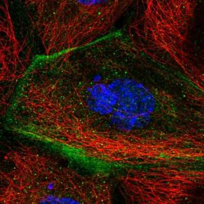 Immunocytochemistry/ Immunofluorescence: TMEM63B Antibody [NBP2-58473]