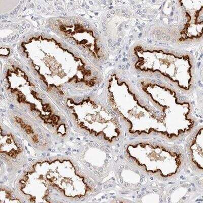 Immunohistochemistry-Paraffin: TMEM63B Antibody [NBP2-13454]