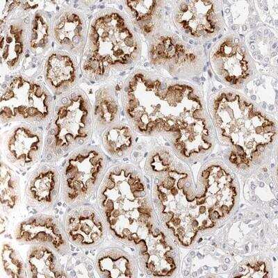 Immunohistochemistry-Paraffin: TMEM63B Antibody [NBP2-13455]