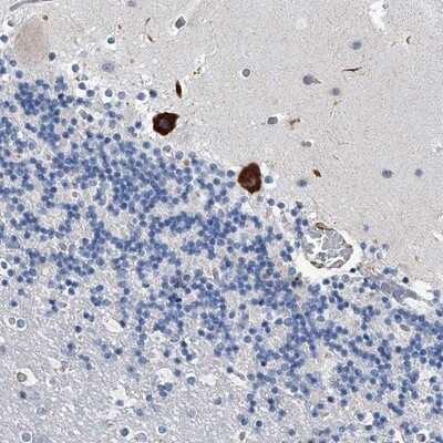 Immunohistochemistry-Paraffin: TMEM63C Antibody [NBP1-90728]