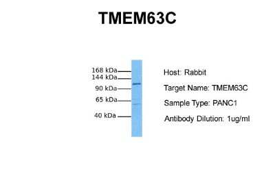 Western Blot: TMEM63C Antibody [NBP2-83695]