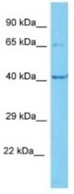 Western Blot: TMEM64 Antibody [NBP3-10163]