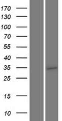 Western Blot: TMEM64 Overexpression Lysate [NBP2-10142]