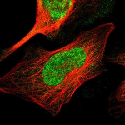 Immunocytochemistry/ Immunofluorescence: TMEM65 Antibody [NBP1-85970]