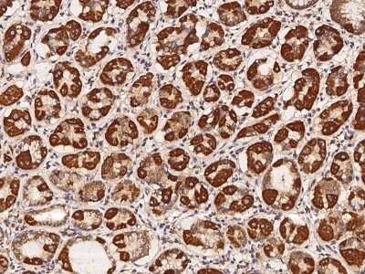 Immunohistochemistry-Paraffin: TMEM65 Antibody [NBP2-98148]