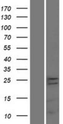 Western Blot: TMEM65 Overexpression Lysate [NBP2-04757]