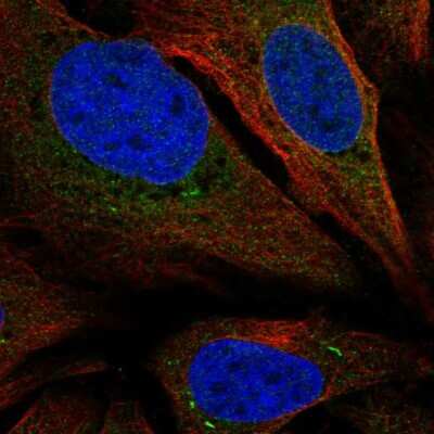 Immunocytochemistry/ Immunofluorescence: TMEM66 Antibody [NBP2-56163]