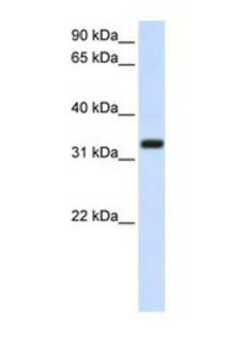 Western Blot: TMEM66 Antibody [NBP1-69489]