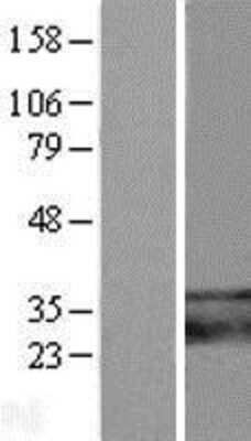 Western Blot: TMEM66 Overexpression Lysate [NBL1-17098]