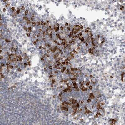 Immunohistochemistry-Paraffin: TMEM69 Antibody [NBP1-90713]