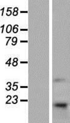 Western Blot: TMEM69 Overexpression Lysate [NBP2-07024]