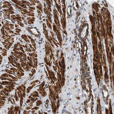 Immunohistochemistry: TMEM70 Antibody [NBP2-13456]