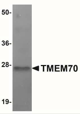 Western Blot: TMEM70 AntibodyBSA Free [NBP1-77131]