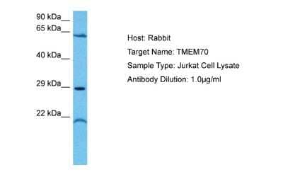 Western Blot: TMEM70 Antibody [NBP2-85953]