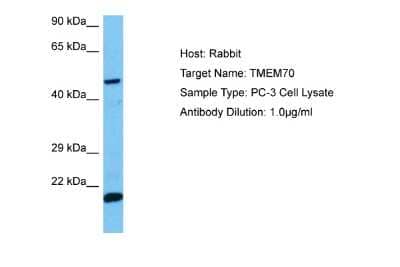 Western Blot: TMEM70 Antibody [NBP2-85954]