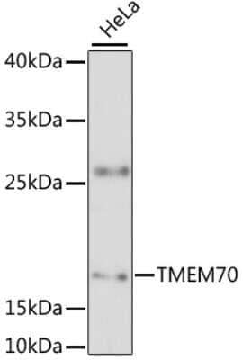 Western Blot: TMEM70 AntibodyAzide and BSA Free [NBP2-94628]