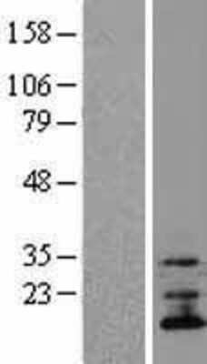 Western Blot: TMEM70 Overexpression Lysate [NBL1-17101]