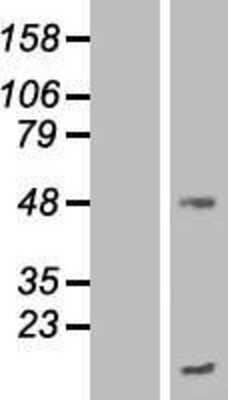 Western Blot: TMEM70 Overexpression Lysate [NBP2-08514]