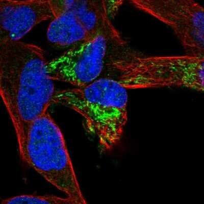 Immunocytochemistry/ Immunofluorescence: TMEM71 Antibody [NBP2-37968]