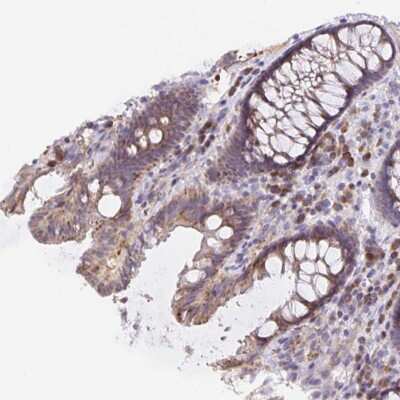 Immunohistochemistry: TMEM71 Antibody [NBP2-37968]