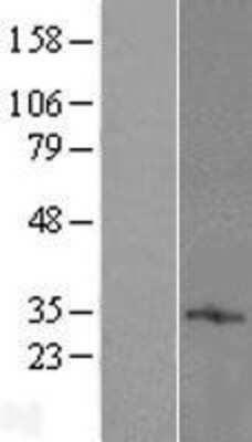 Western Blot: TMEM71 Overexpression Lysate [NBL1-17102]