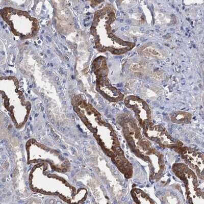 Immunohistochemistry-Paraffin: TMEM72 Antibody [NBP1-90808]