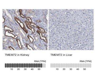 Immunohistochemistry-Paraffin: TMEM72 Antibody [NBP1-90808]