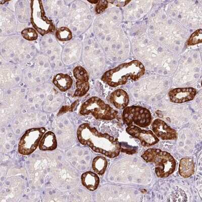 Immunohistochemistry-Paraffin: TMEM72 Antibody [NBP2-49377]