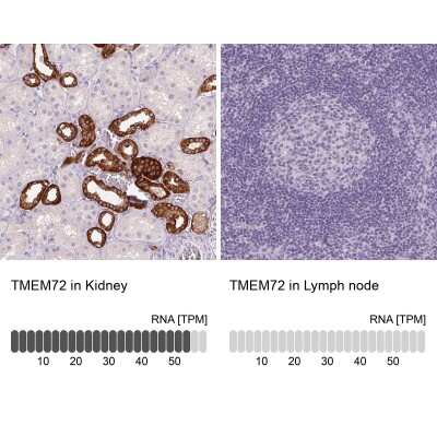 Immunohistochemistry-Paraffin: TMEM72 Antibody [NBP2-49377]