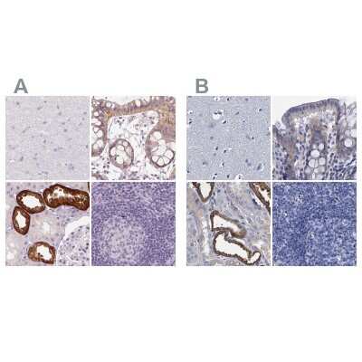 Immunohistochemistry-Paraffin: TMEM72 Antibody [NBP2-49377]