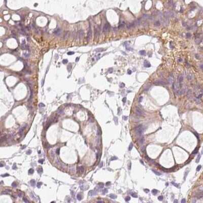 Immunohistochemistry-Paraffin: TMEM72 Antibody [NBP2-49377]