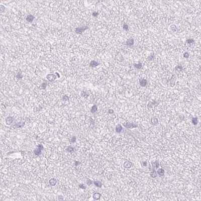 Immunohistochemistry-Paraffin: TMEM72 Antibody [NBP2-49377]