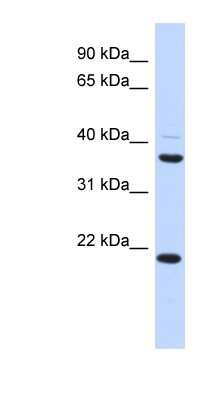 Western Blot: TMEM74 Antibody [NBP1-60092]