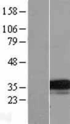 Western Blot: TMEM74 Overexpression Lysate [NBL1-17103]