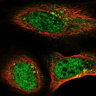 Immunocytochemistry/ Immunofluorescence: TMEM74B Antibody [NBP1-94038]