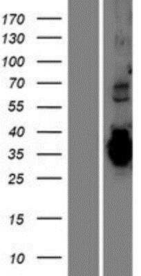 Western Blot: TMEM74B Overexpression Lysate [NBP2-06815]