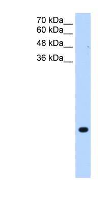 Western Blot: TMEM75 Antibody [NBP1-59685]