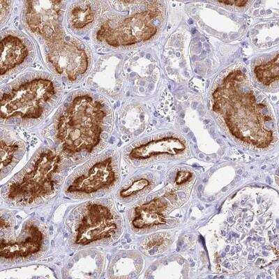 Immunohistochemistry-Paraffin: TMEM78 Antibody [NBP1-93786]