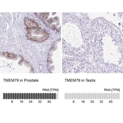 Immunohistochemistry-Paraffin: TMEM79 Antibody [NBP2-47601]