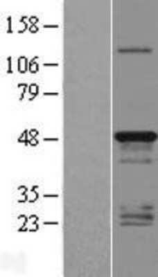 Western Blot: TMEM79 Overexpression Lysate [NBL1-17104]