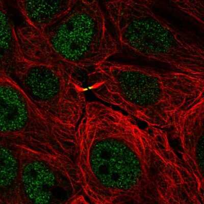 Immunocytochemistry/ Immunofluorescence: TMEM8 Antibody [NBP2-30919]