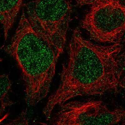 Immunocytochemistry/ Immunofluorescence: TMEM8 Antibody [NBP2-55929]