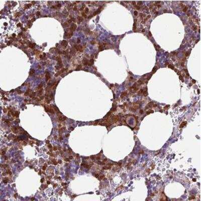 Immunohistochemistry: TMEM8 Antibody [NBP2-30919]